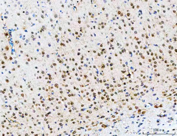 a06584 1 psmd14 primary antibodies ihc testing 9