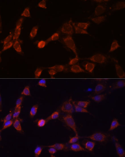 a06584 psmd14 primary antiboties if testing 2