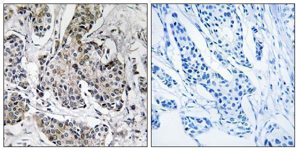 a06585 1 prkx primary antibodies ihc testing 1