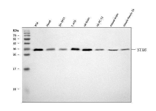  Western blot analysis of Syntaxin 6/STX6 using anti-Syntaxin 6/STX6 antibody (A06586-1)