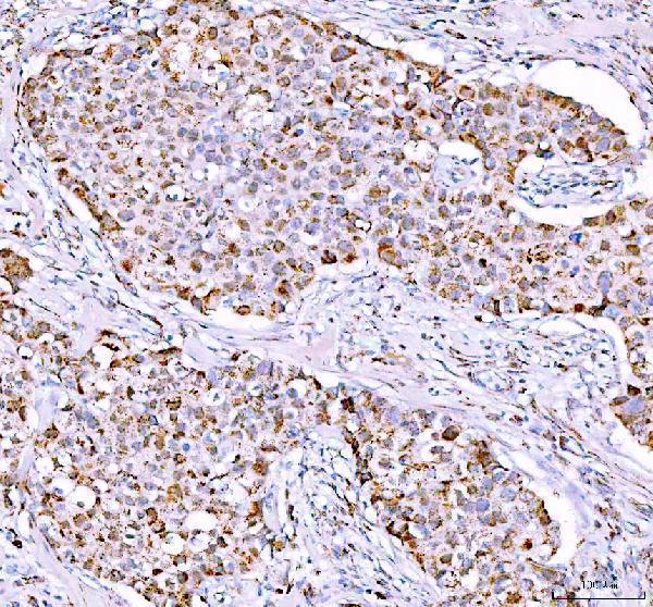  IHC analysis of PPA2 using anti-PPA2 antibody (A06587)