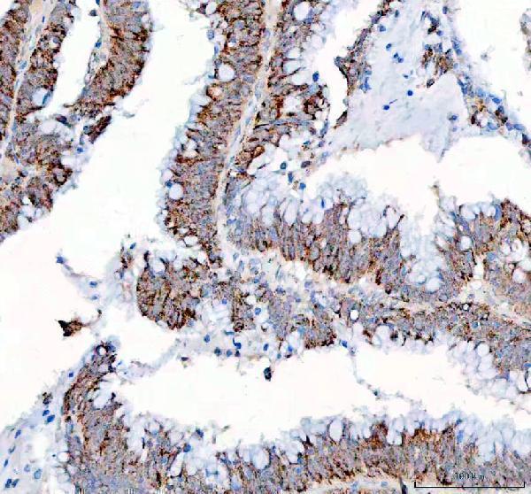  IHC analysis of PPA2 using anti-PPA2 antibody (A06587)