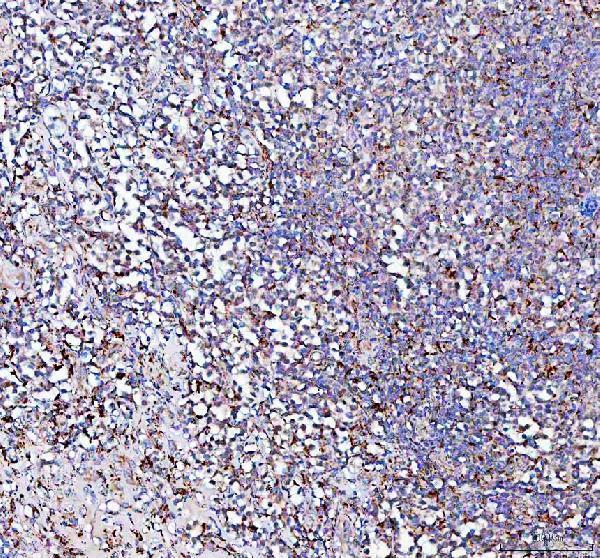 a06587 ppa2 primary antibodies ihc testing 5