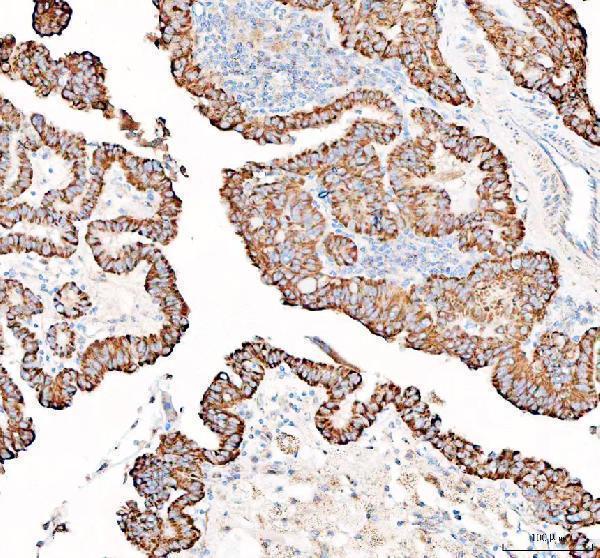 a06587 ppa2 primary antibodies ihc testing 6