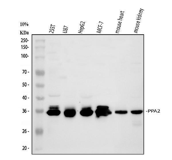  Western blot analysis of PPA2 using anti-PPA2 antibody (A06587)