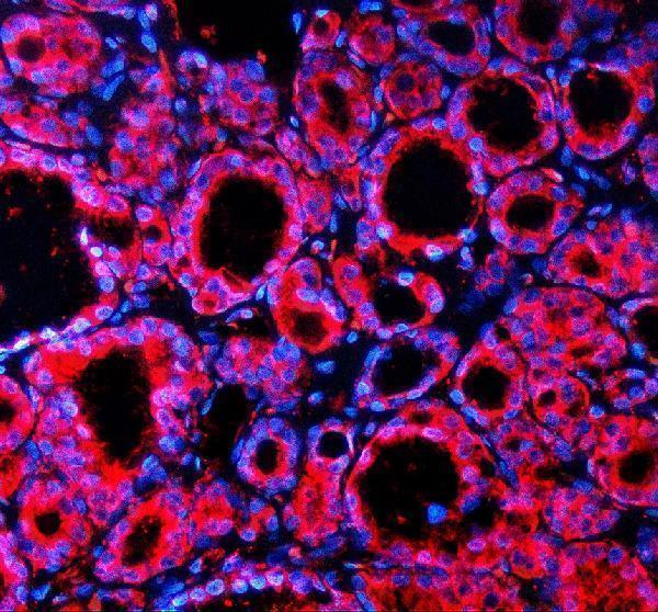 a06588 1 spock1 primary antibodies if testing 1