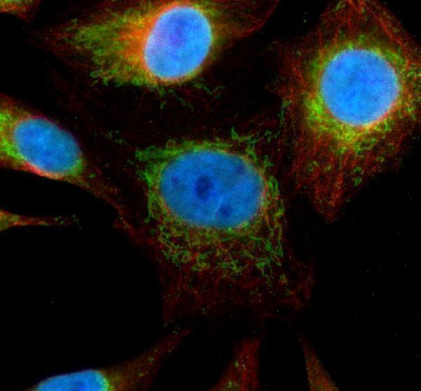 a06593 2 chchd3 primary antibodies if testing 1