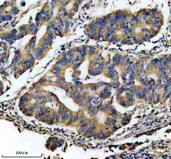 a06593 2 chchd3 primary antibodies ihc testing 1