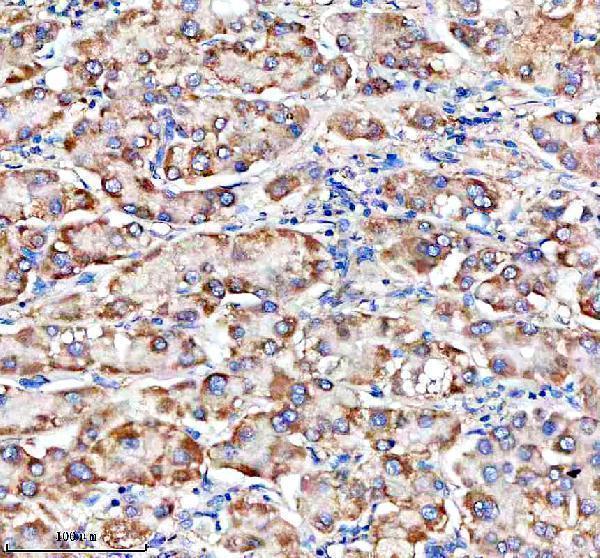  IHC analysis of CHCHD3 using anti-CHCHD3 antibody (A06593-2)