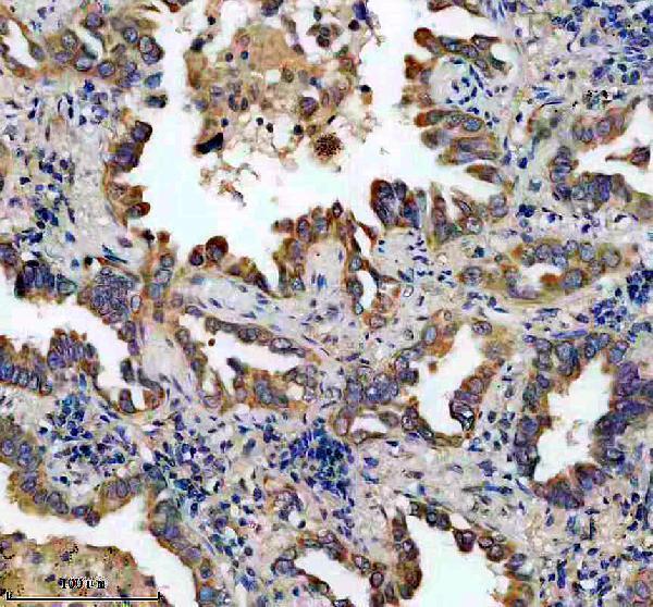 a06593 2 chchd3 primary antibodies ihc testing 2_1