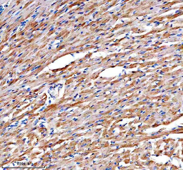 IHC analysis of CHCHD3 using anti-CHCHD3 antibody (A06593-2)