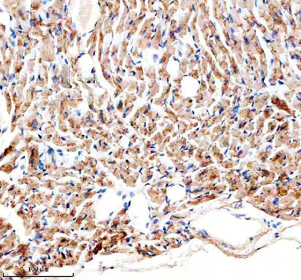 a06593 2 chchd3 primary antibodies ihc testing 4