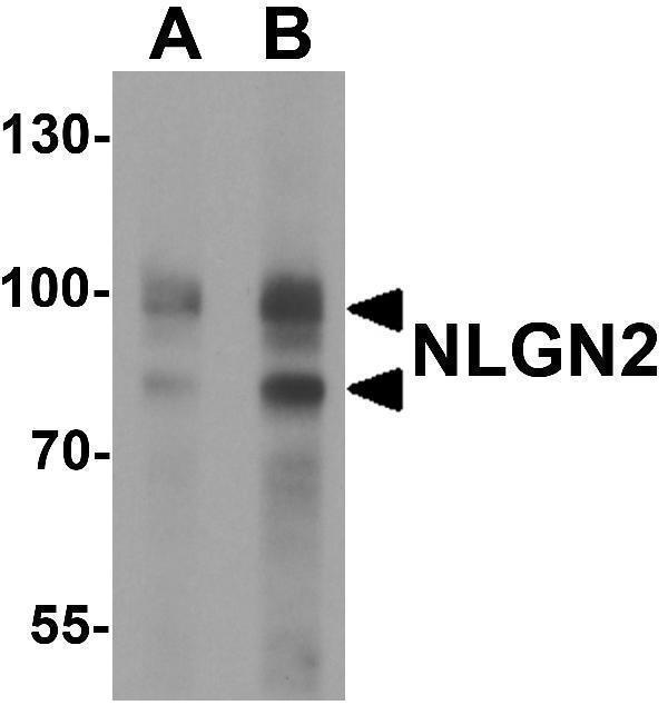 a06595 nlgn2 primary antibodies wb testing 1