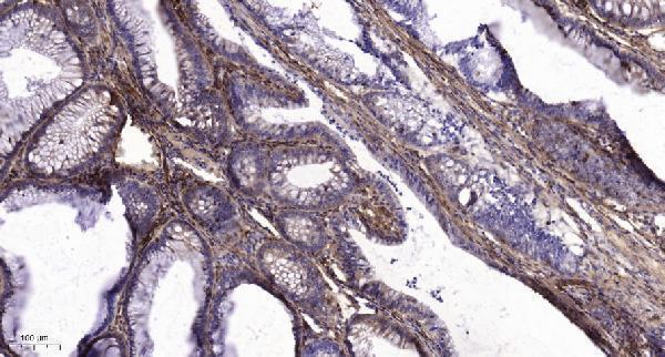 a06597 lpar3 primary antibodies ihc testing 4