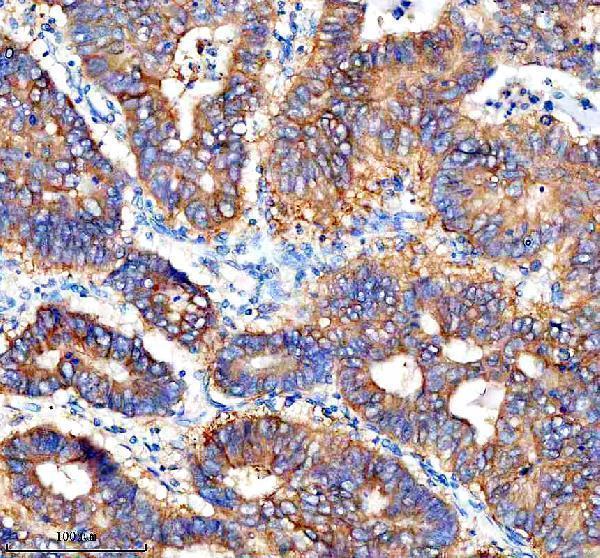 a06600 1 cathepsin_f ctsf primary antibodies ihc testing 2
