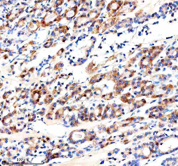 a06600 1 cathepsin_f ctsf primary antibodies ihc testing 3