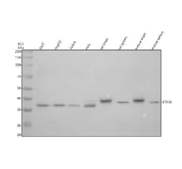 Western blot analysis of Syntaxin 16/STX16 using anti-Syntaxin 16/STX16 antibody (A06602-1)