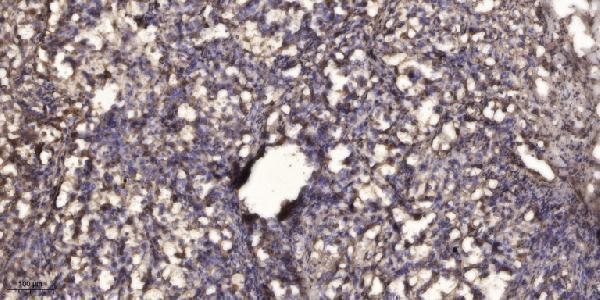 a06605 1 kcnj4 primary antibodies ihc testing 1