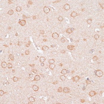 a06605 2 kcnj4 primary antiboties ihc testing 2