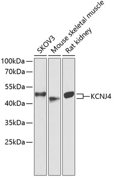 a06605 2 kcnj4 primary antiboties wb testing 1