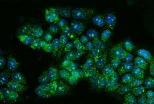  IF analysis of TBX4 using anti-TBX4 antibody (A06607-1)