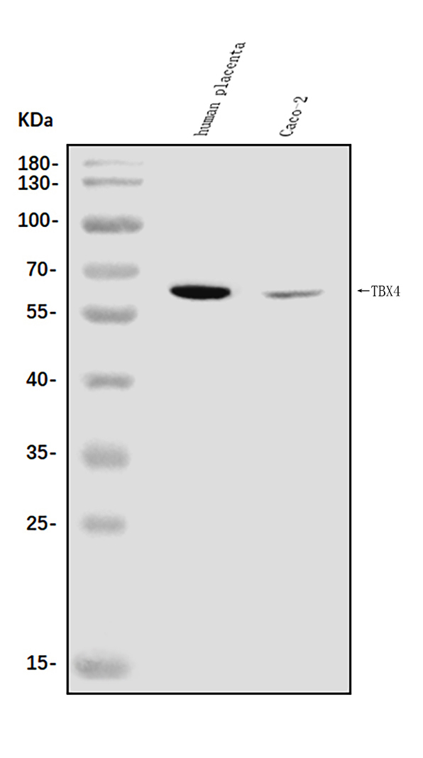  Western blot analysis of TBX4 using anti-TBX4 antibody (A06607-1)