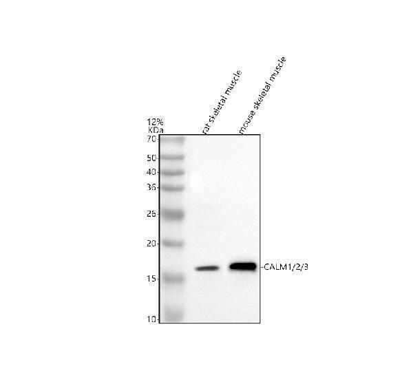 a06609 1 calm1 2 3 primary antibodies wb testing 1