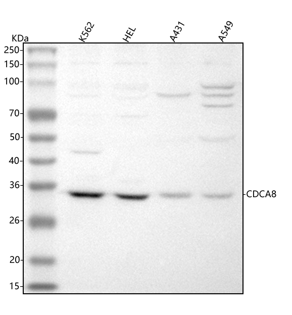  Western blot analysis of CDCA8 using anti-CDCA8 antibody (A06612-2)