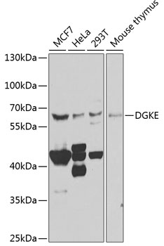 Western blot analysis of extracts of various cell lines, using DGKE antibody  at 1:1000 dilution