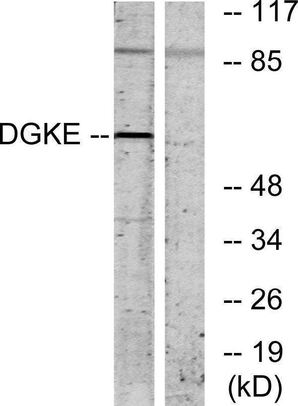 Western blot analysis of lysates from K562 cells, using DGKE Antibody