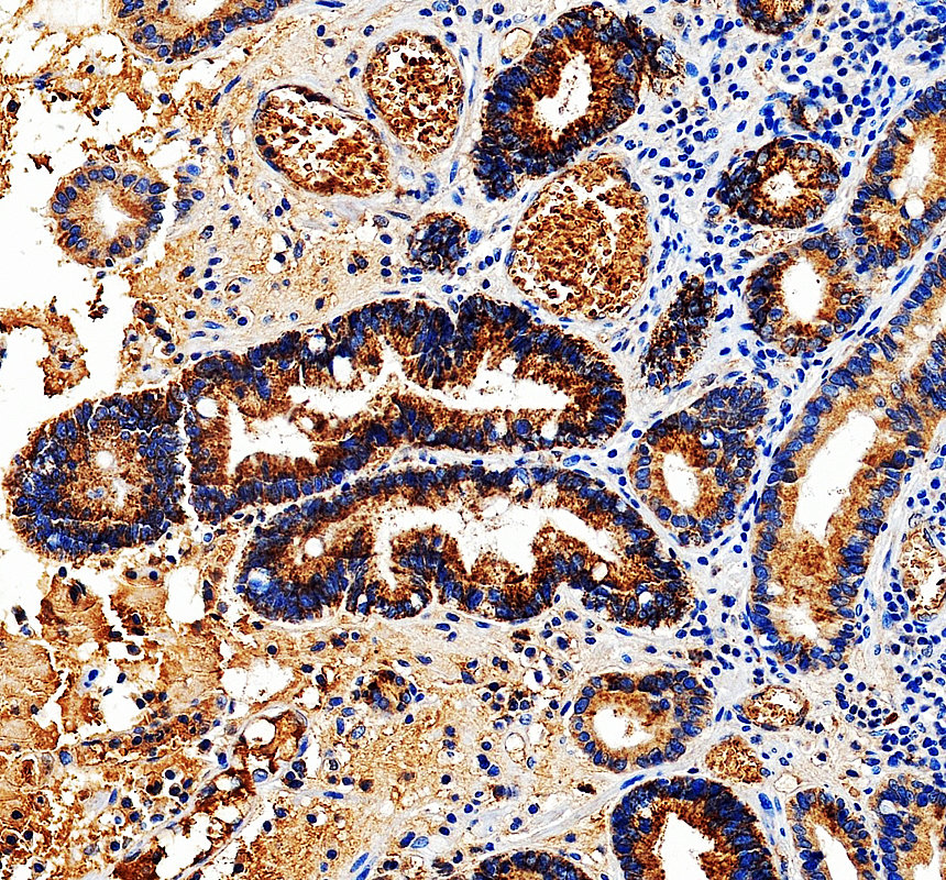 a06617 1 rasgrf2 primary antibodies ihc testing 1