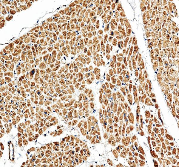 IHC analysis of KIF1C using anti-KIF1C antibody (A06621-1)