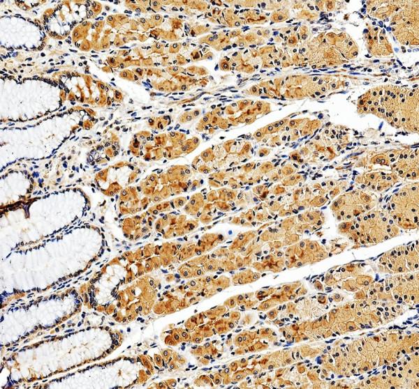 IHC analysis of KIF1C using anti-KIF1C antibody (A06621-1)