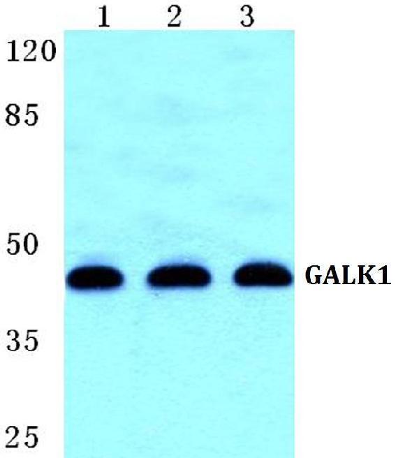a06627 1 galk1 primary antiboties wb testing 1