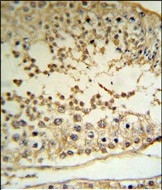 a06628 1 anti mape antibody c term ihc p testing 2