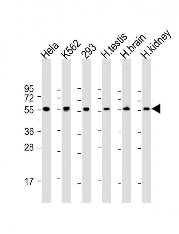 a06628 1 anti mape antibody c term wb testing 1