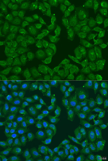 a06632 msrb3 primary antiboties if testing 2
