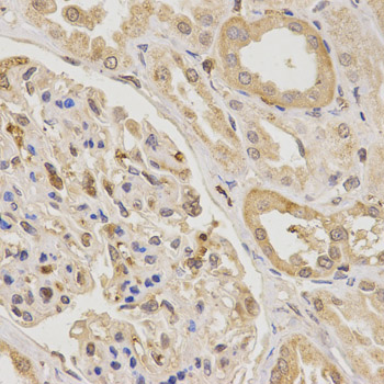 Immunohistochemistry (IHC) analysis of Urotensin II polyclonal antibody in paraffin-embedded Human Kidney tissue