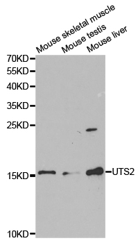 Western blot (WB) analysis of Urotensin II polyclonal antibody