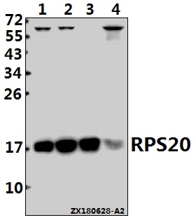 Western blot (WB) analysis of RPS20 (K67) pAb at 1:500 dilution
Lane1:MCF-7 whole cell lysate(20ug)
Lane2:SGC7901 whole cell lysate(20ug)
Lane3:The Embryo tissue lysate of Mouse(20ug)
Lane4:The Brain tissue lysate of Rat(40ug)