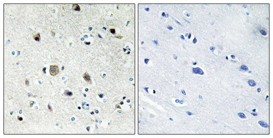 a06634s20 rps20 primary antibodies ihc testing 3