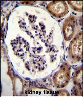 a06636 1 anti itga8 antibody c term ihc p testing 3