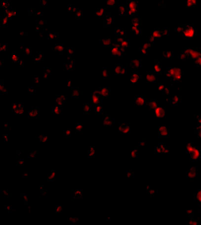 Immunofluorescence of TIM-4 in Jurkat cells with TIM-4 antibody at 20 μg/mL