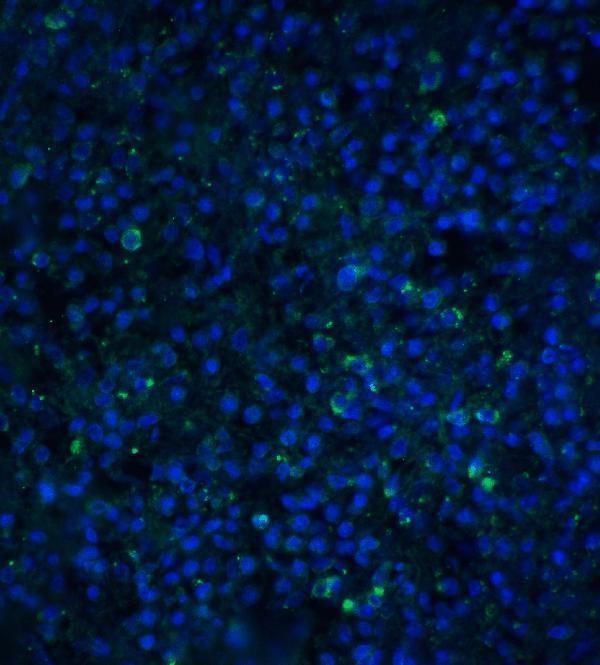 a06637 1 timd4 primary antibodies if testing 5