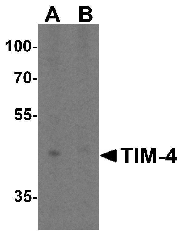 Western blot analysis of TIM-4 in RAW264