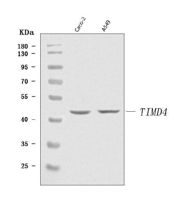  Western blot analysis of TIM 4/TIMD4 using anti-TIM 4/TIMD4 antibody (A06637-2)
