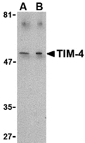 a06637 timd4 primary antibodies wb testing 1