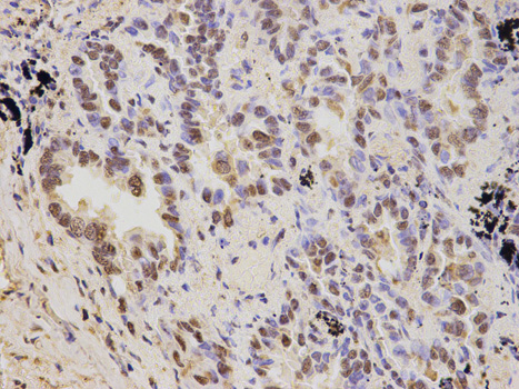 a06642 1 psmd2 primary antiboties if testing 2