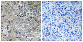 a06642 2 psmd2 primary antibodies ihc testing 1
