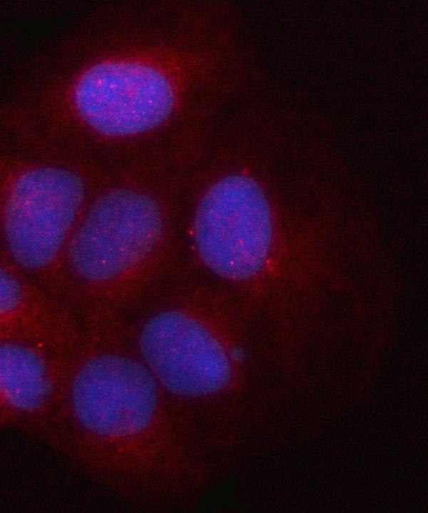  IF analysis of PSMD2 using anti-PSMD2 antibody (A06642-3)